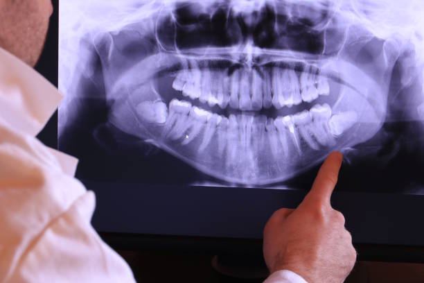 Best Emergency Root Canal Treatment in Davis, CA