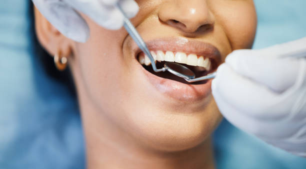 Best Cosmetic Emergency Dentistry in Davis, CA